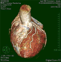 心臓　冠動脈像